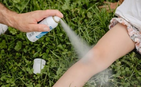 kaj pomaga za opekline