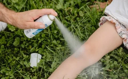 kaj pomaga za opekline