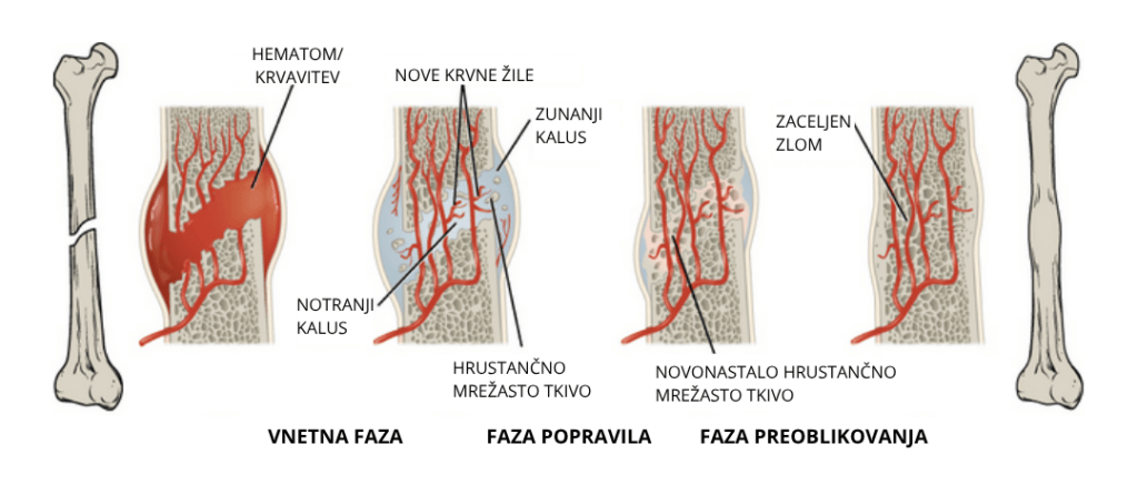 faze celjenja kosti