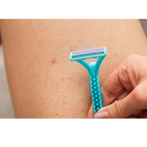 folikulitis